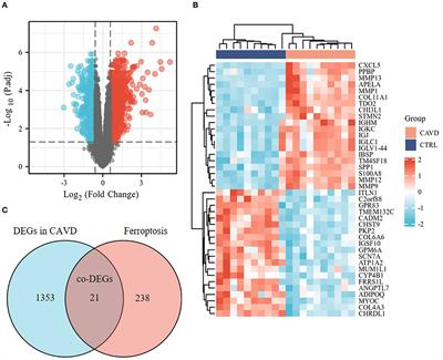 Potential ferroptosis key genes in calcific aortic valve disease